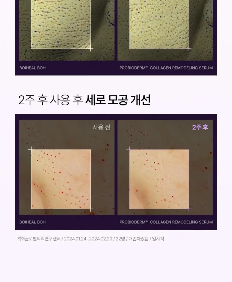 [콜라겐|모공고민] 바이오힐보 프로바이오덤 콜라겐 리모델링 세럼 30ml [증정/더블기획] 상세페이지 26